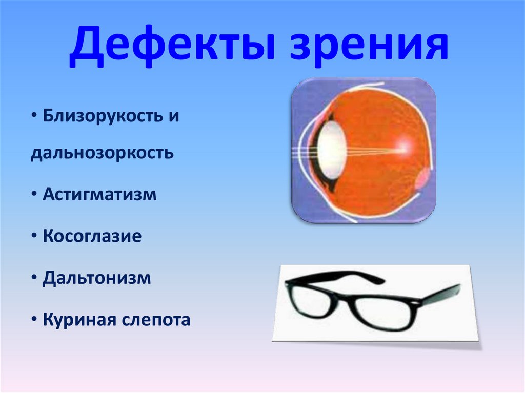 Реферат дефекты зрения как сохранить зрение