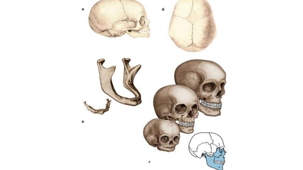 Установить соответствие кости черепа. Воздухоносные кости черепа. Возрастные особенности воздухоносных костей черепа. Соотнеси череп с особенностями его строения. Воздухоносные кости черепа строение.
