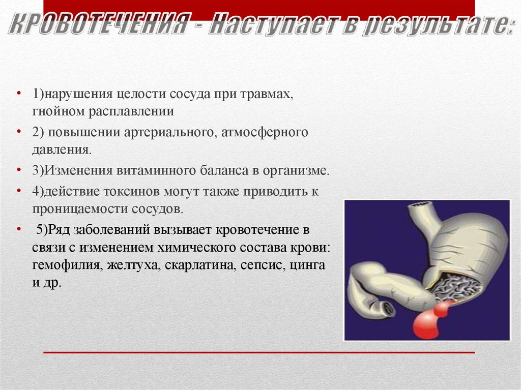 Презентация кровотечения общая хирургия