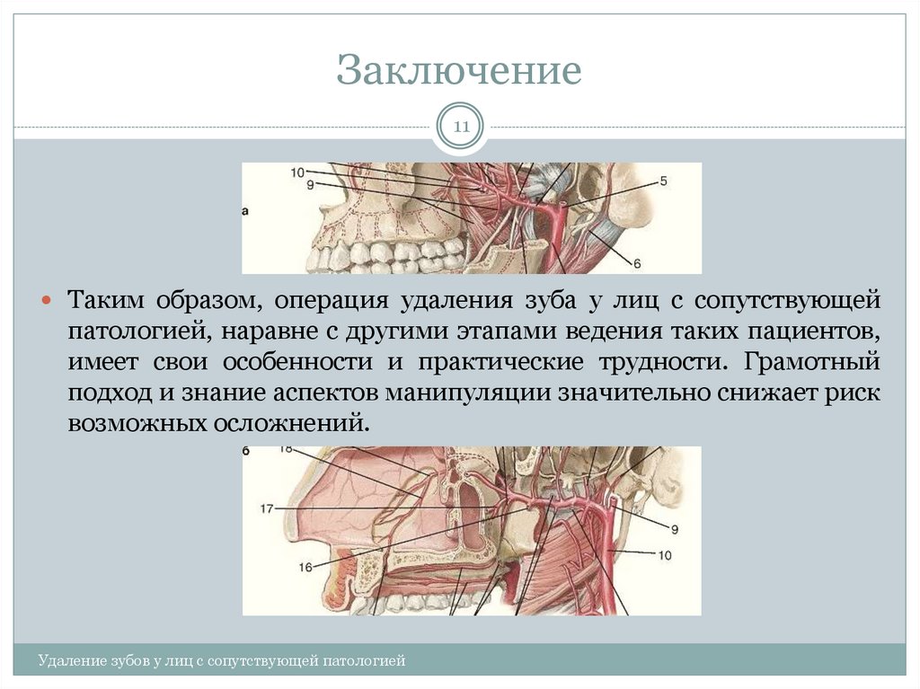 Заключение