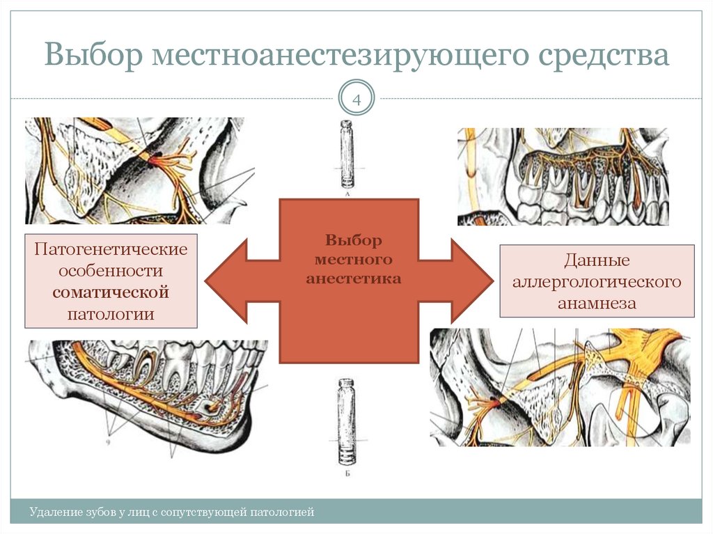 Выбор местноанестезирующего средства