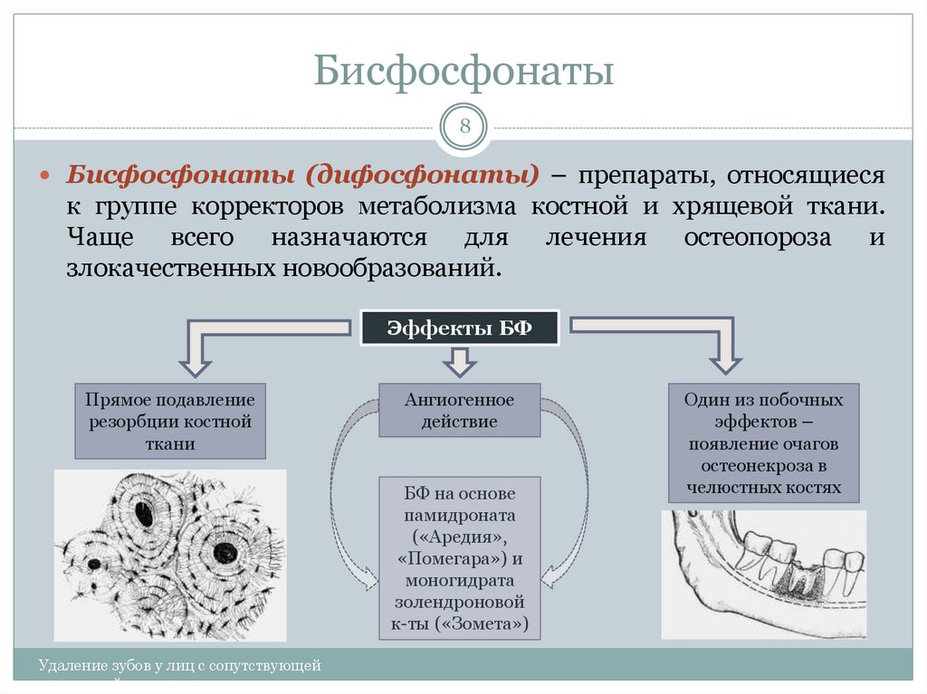 Обмен веществ в костной ткани. Бисфосфонаты группа препаратов. Корректор метаболизма костной и хрящевой ткани. Бисфосфонаты побочные действия. Бисфосфонаты и имплантация.