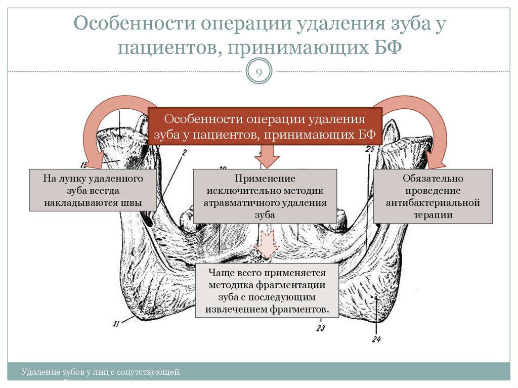 Особенности операций. Особенности операции удаления зуба.. Особенности операции удаления. Особенности удаления зубов у лиц с сопутствующими заболеваниями. Особенности операций на лице.