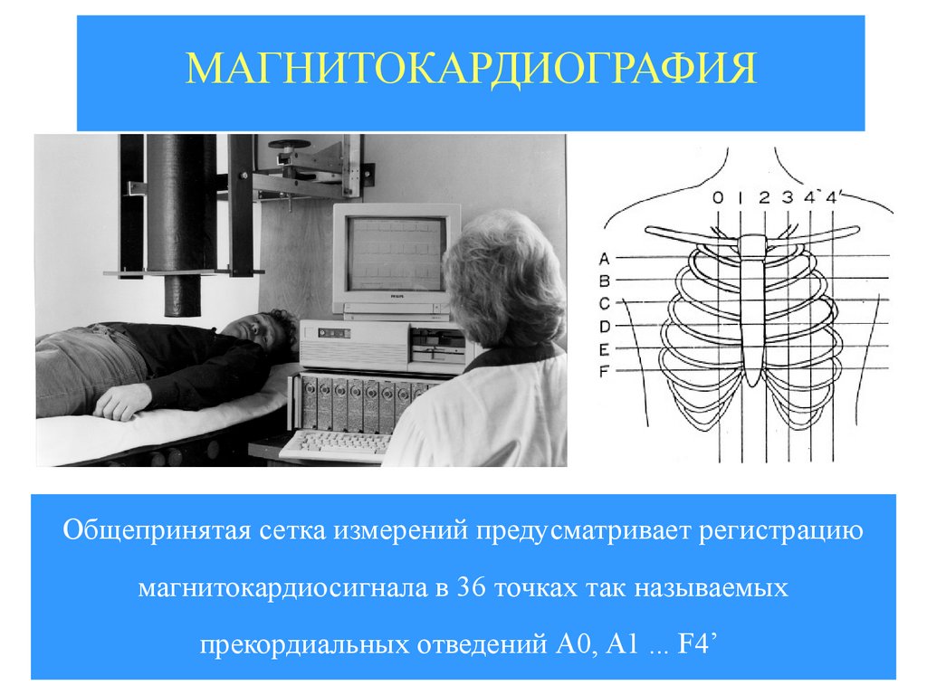 МАГНИТОКАРДИОГРАФИЯ
