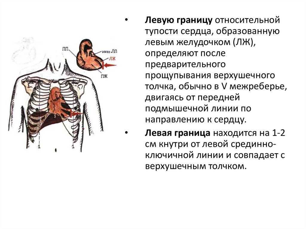 Границы относительной тупости сердца. Перкуссия границ относительной сердечной тупости. Относительная тупость сердца перкуссия норма. Границы относительной тупости сердца перкуссия. Левая граница сердца относительной тупости сердца.