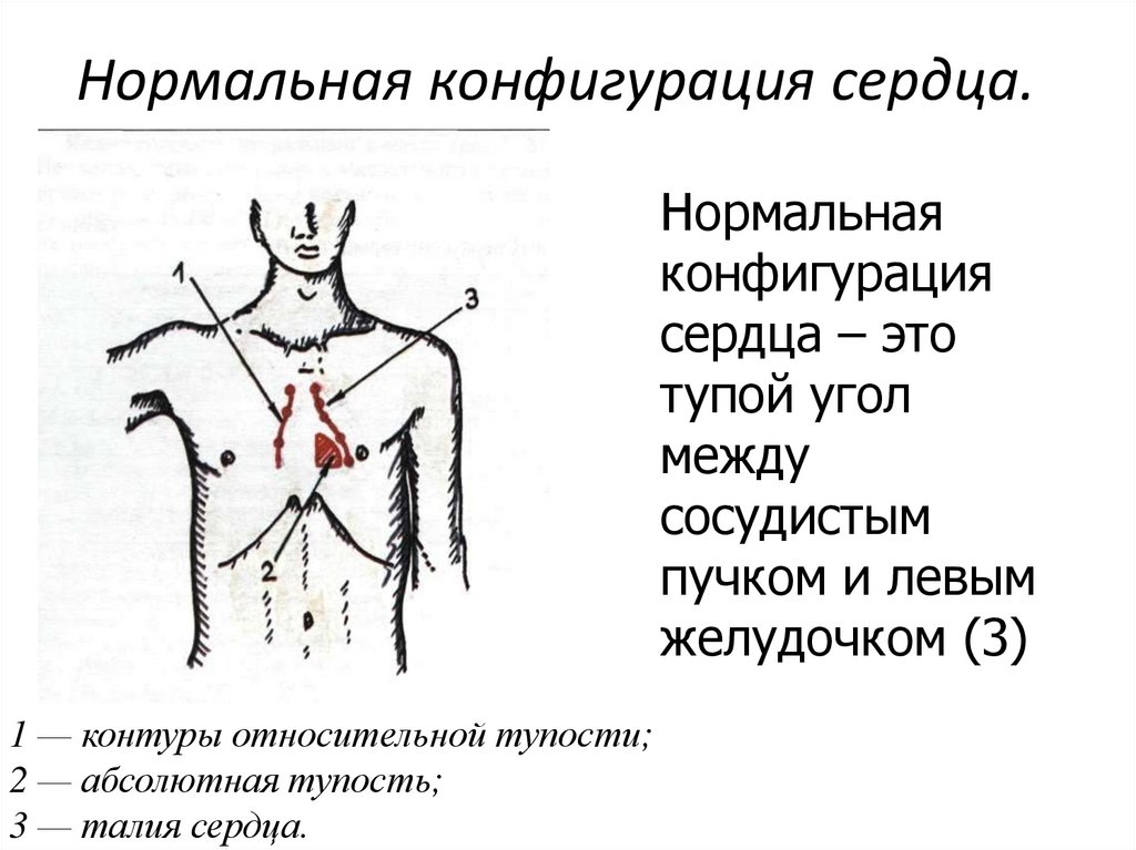 Сосудистый пучок. Конфигурации сердца пропедевтика. Угол между сосудистым пучком и левым желудочком. Перкуссия комплексной конфигурации сердца и сосудистого пучка. Конфигурация относительной тупости сердца.