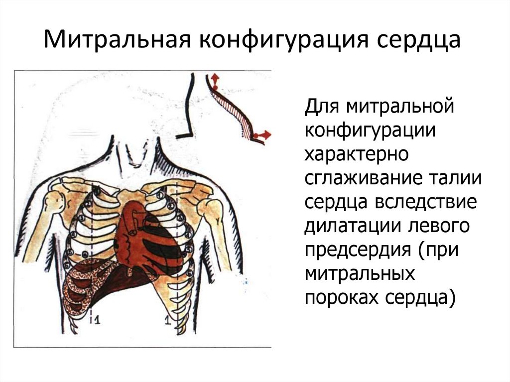 Конфигурация сердца