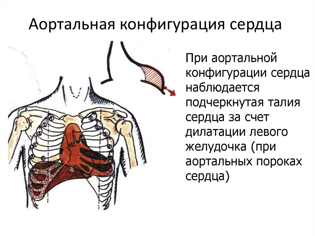 Конфигурация сердца