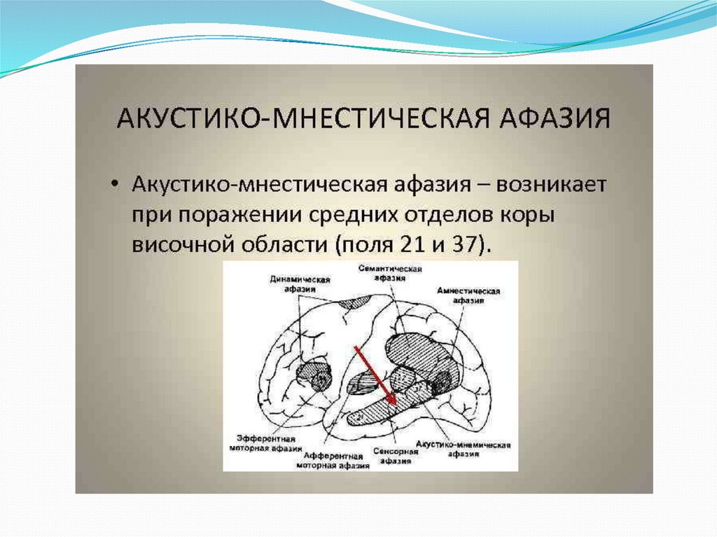 Акустико семантической афазии