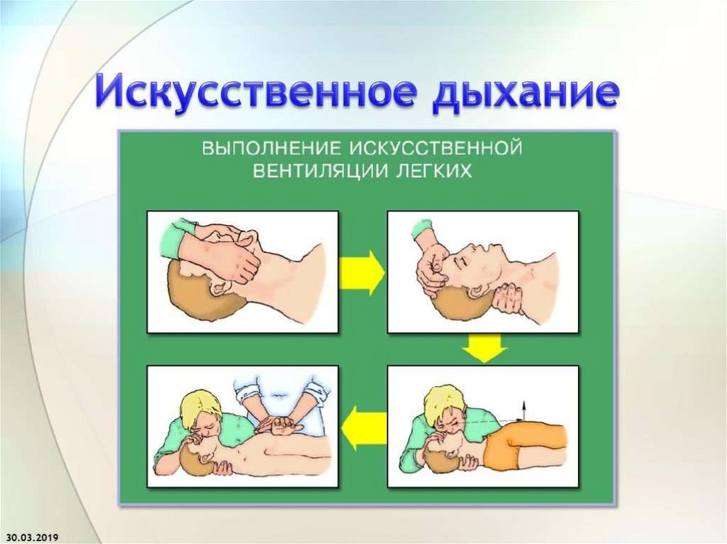 Искусственное дыхание презентация