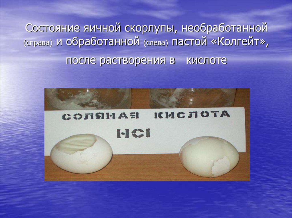 Состояние яичной скорлупы, необработанной (справа) и обработанной (слева) пастой «Колгейт», после растворения в кислоте