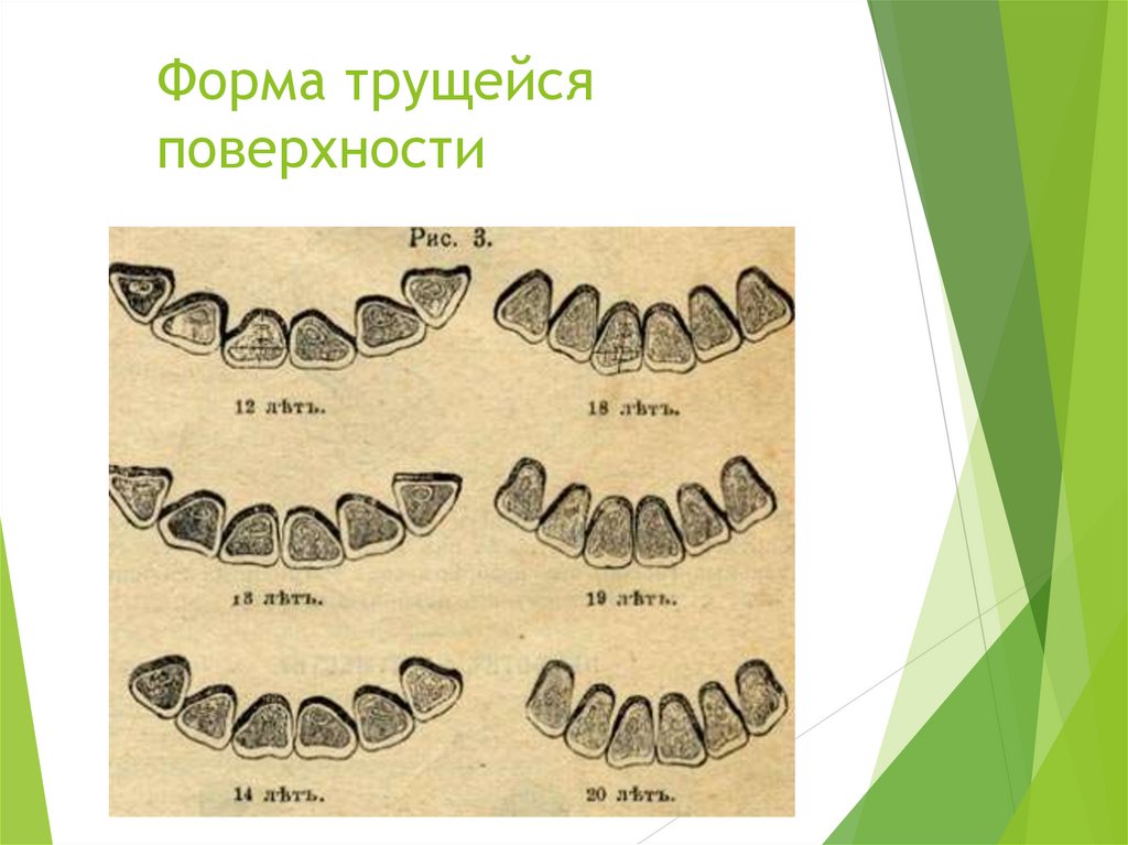 Схема форм зубов лошади по возрасту. Определить Возраст волка. Определите Возраст ребенка по зубам.