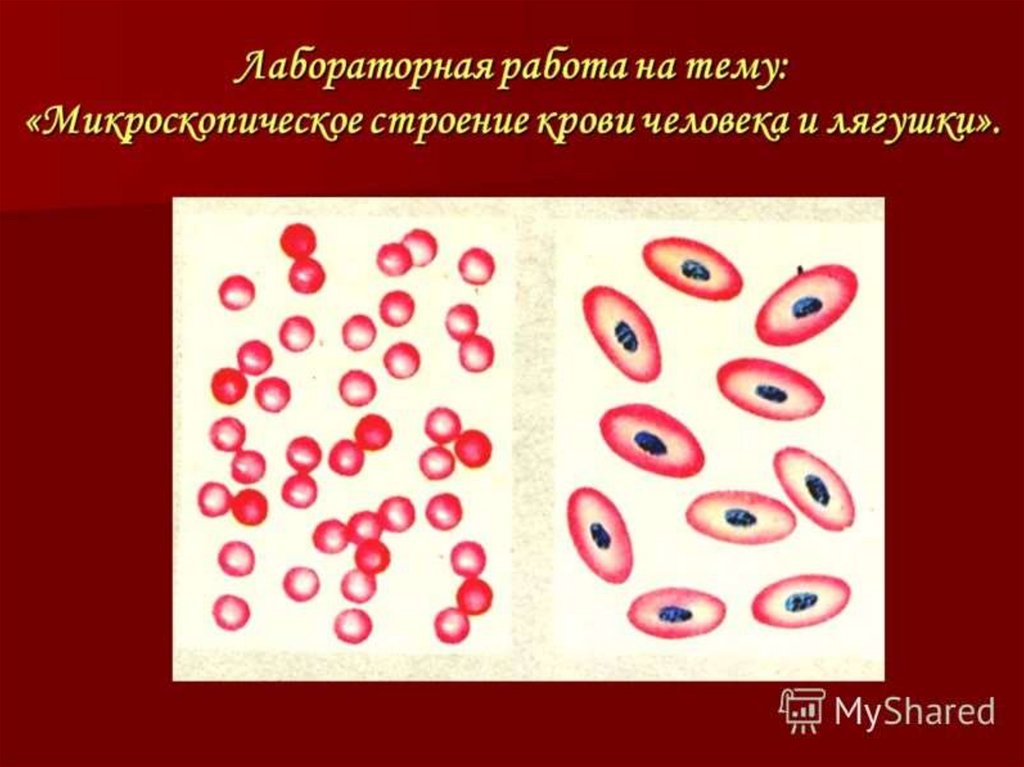 Рисунок эритроцита. Микроскопическое строение крови. Строение крови лягушки. Строение крови человека. Эритроциты человека и лягушки.