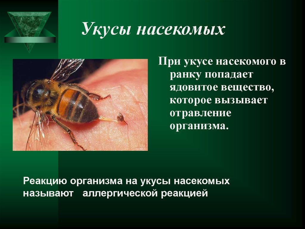 Обж 6 класс помощь при укусах. Укусы насекомых симптомы. Укусы ядовитых насекомых. Оказание первой помощи при укусах насекомых.
