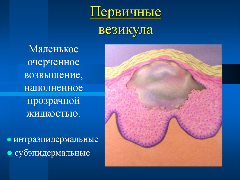 Первичные везикула