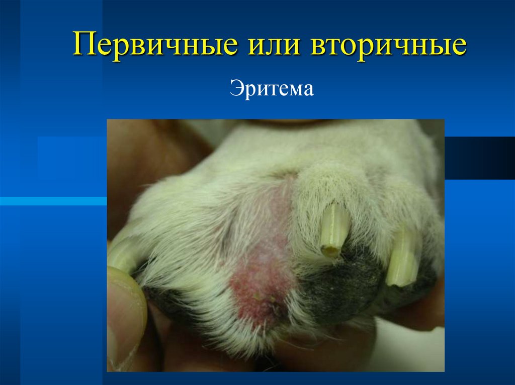 Первичные или вторичные