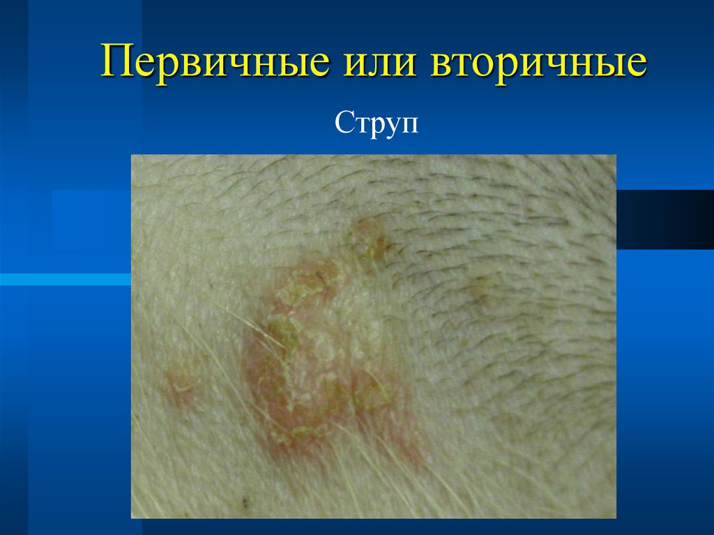 Первичные или вторичные