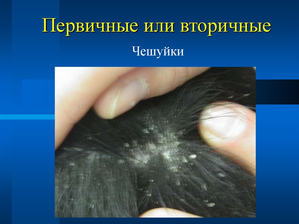 Первичные или вторичные