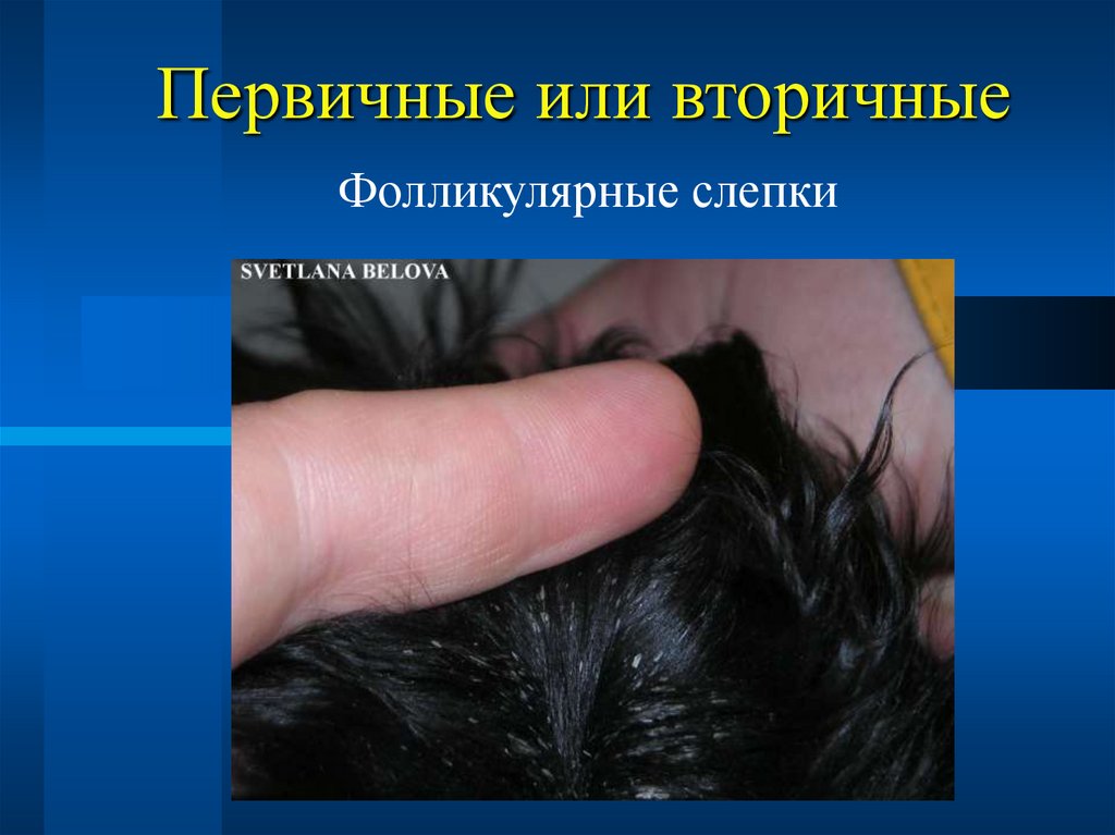 Первичные или вторичные