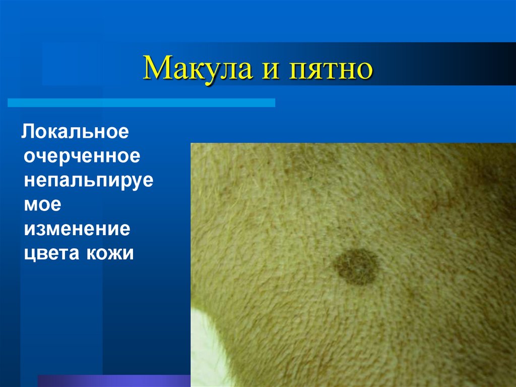 Макула и пятно