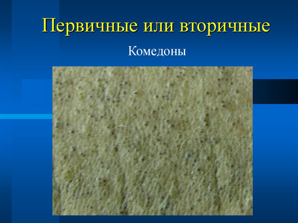 Первичные или вторичные