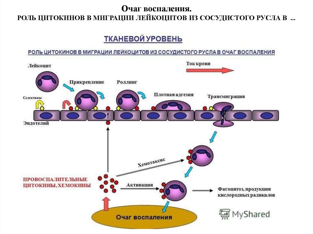 Схемы воспалительную реакцию тканей на внедрение микробов