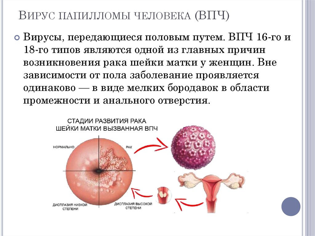 Папиломы вирус передается чем лечить. ВПЧ передается половым путем. Вирус папилломы человека что это и как передается. Папиллома человека это ЗППП.