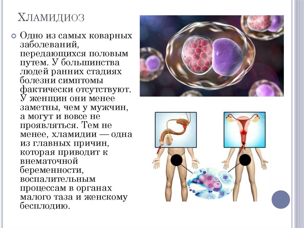 Инфекции передающиеся половым путем картинки