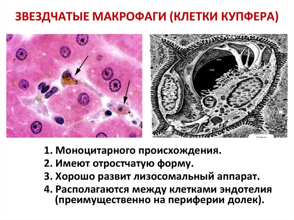 Клетками макрофагами являются. Звездчатые макрофаги клетки Купфера. Макрофаги Купфера гистология. Звездчатые макрофаги (клетки Купфера) печени способны:. Клетки Купфера препарат.