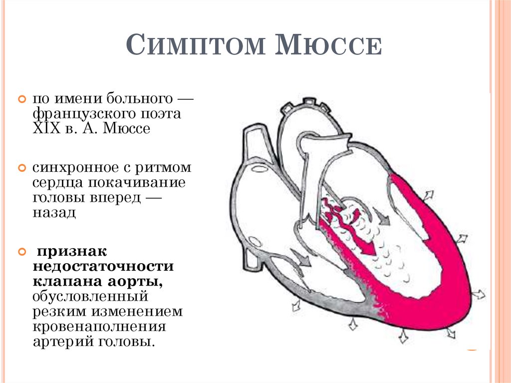 Положительный френикус симптом