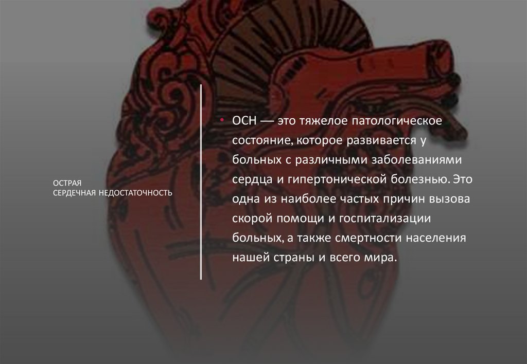 Острая сердечная недостаточность