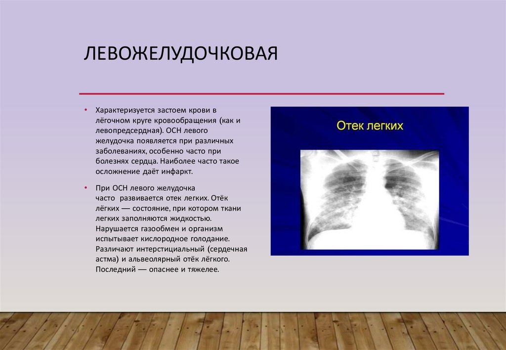 Отек легких формы. Декомпенсация по левожелудочковому типу. Левожелудочковая недостаточность сердечная астма. Левожелудочковая недостаточность хроническая презентация. Фасцикулярная левожелудочковая тахикардия.