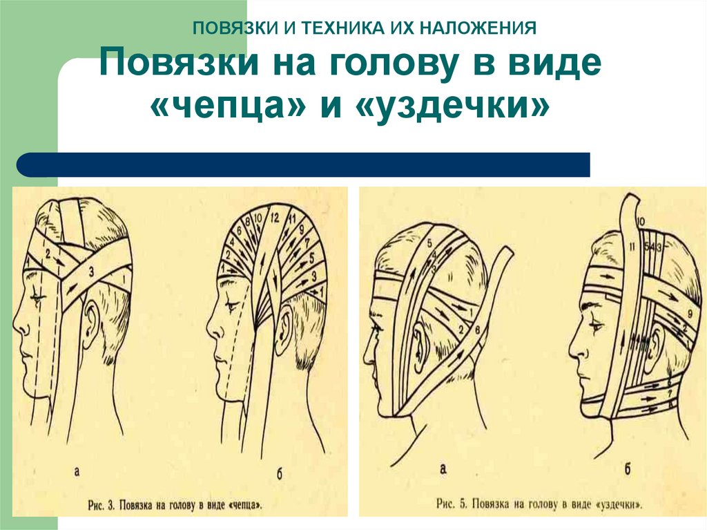 Виды повязок и способы их наложения с картинками для школьников