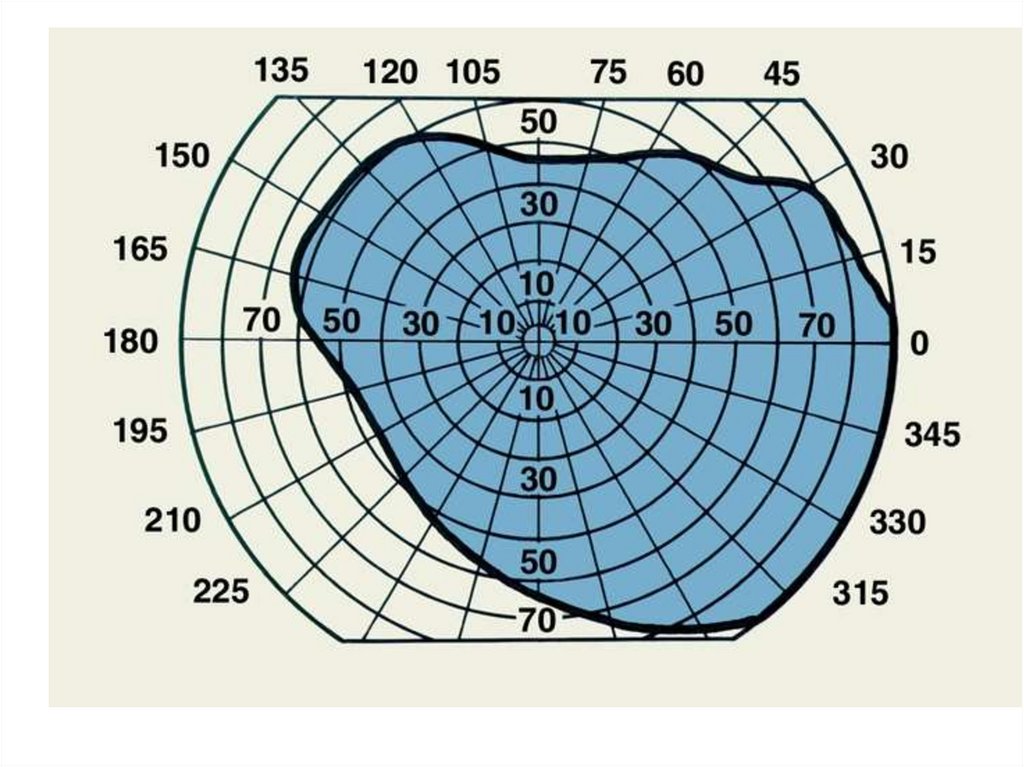 Увеличение полей зрения. Поля зрения в норме схема. Исследование полей зрения норма. Периметрия поля зрения норма. Исследование периферического зрения норма.