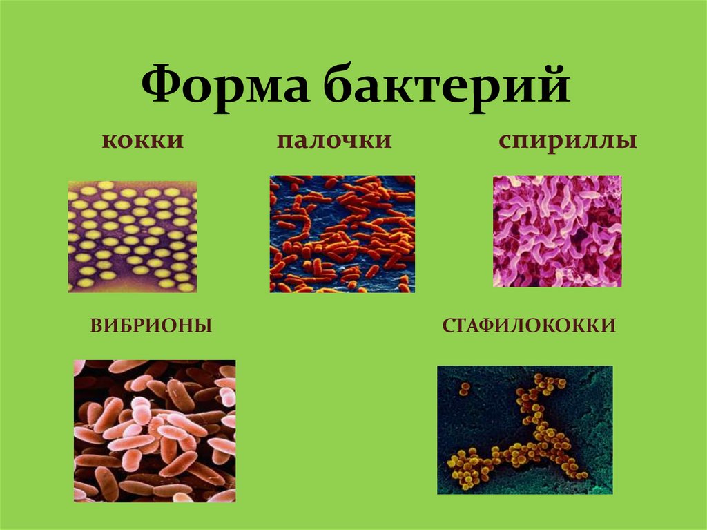 Жизнедеятельность бактерий 5. Палочки кокки бациллы. Строение и жизнедеятельность бактерий. Разнообразные формы бактерий. Строение и формы бактерий.