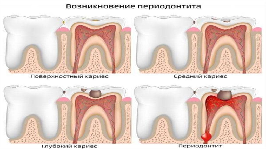 Кариес крым карта