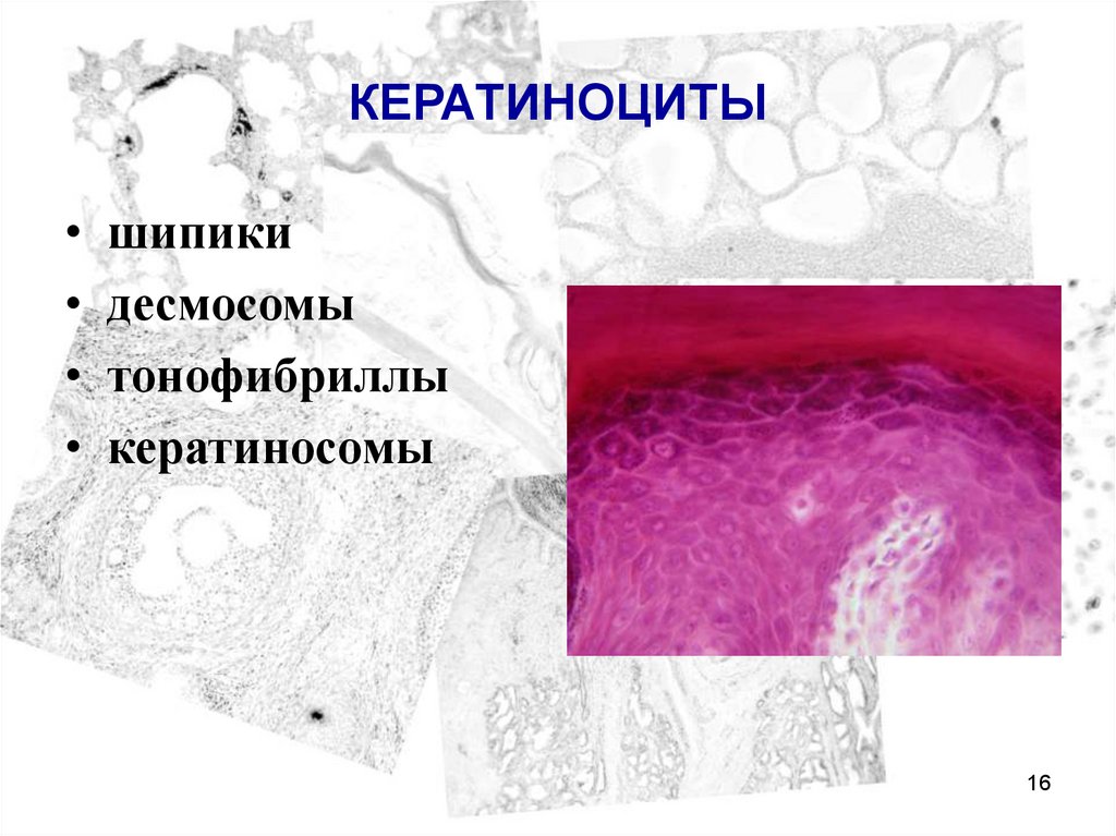 Кератиноциты