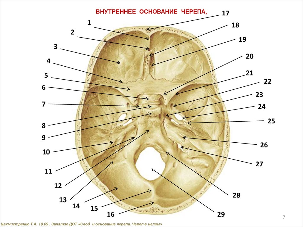 Внутренний свод черепа. Черепные ямки анатомия. Кости основания черепа анатомия. Внутреннее основание черепа анатомия. Строение черепа вид снизу вид изнутри.