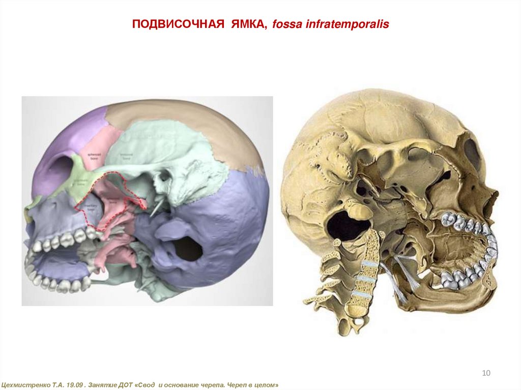 Свод и основание черепа. Подвисочная ямка кт.