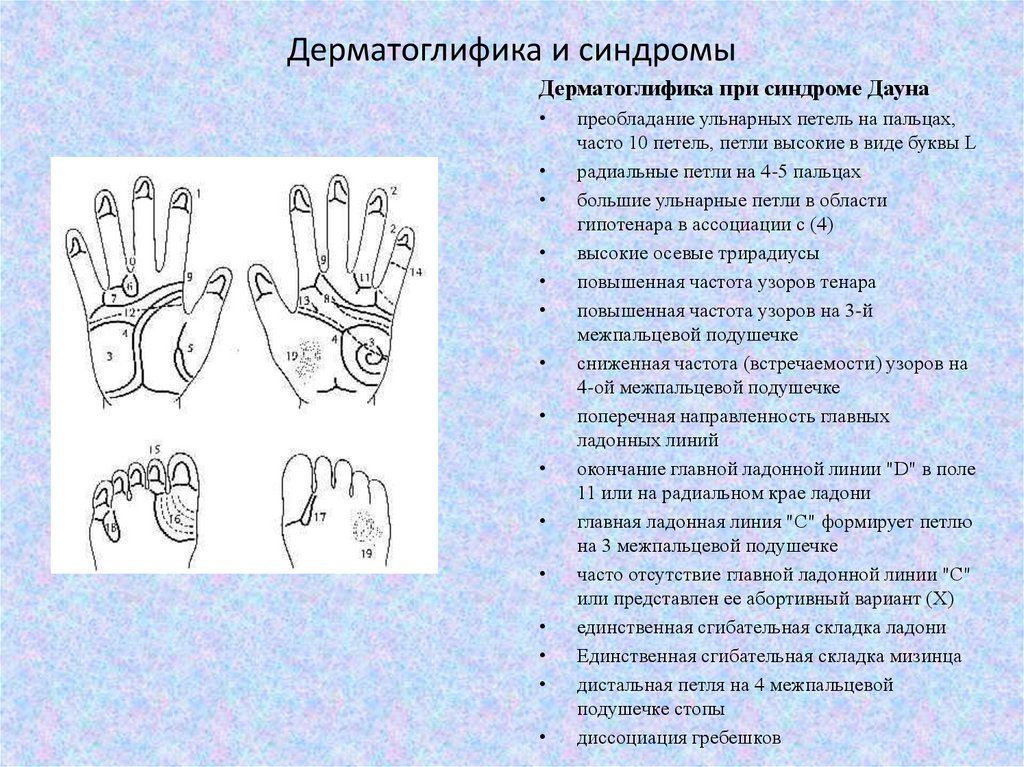 Дерматоглифический метод - презентация онлайн