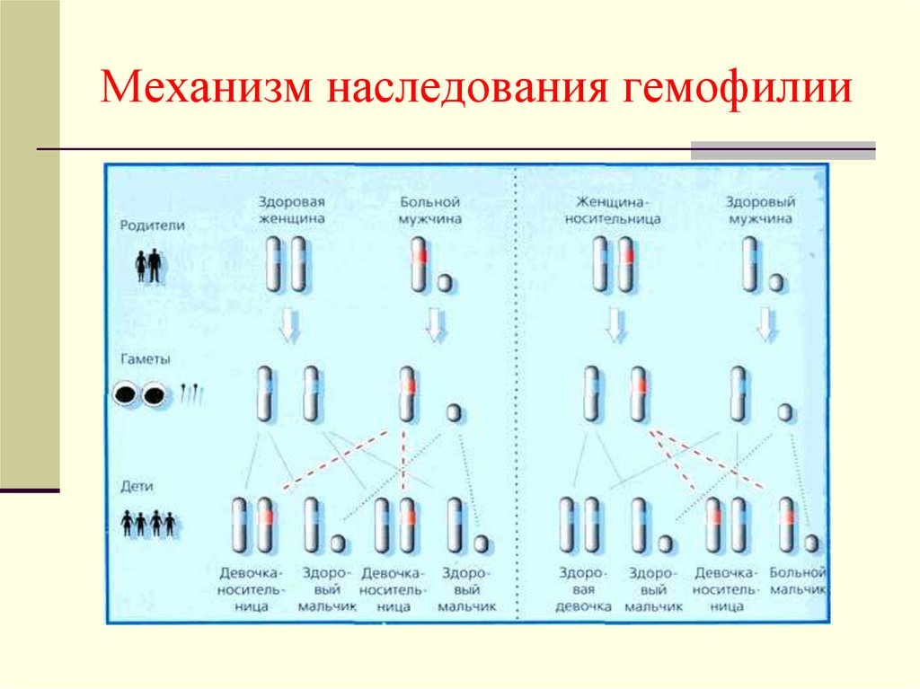 Гемофилия у мужчин и женщин. Гемофилия Тип наследования. Гемофилия кариотип больных. Гемофилия Тип наследования кариотип. Тип наследования при гемофилии Тип с.