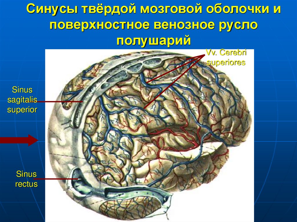 Сосудистая оболочка мозга. Синусы и отростки твердой мозговой оболочки. Синусы твердой оболочки головного мозга анатомия. Венозные синусы твердой мозговой оболочки. Твердая мозговая оболочка.