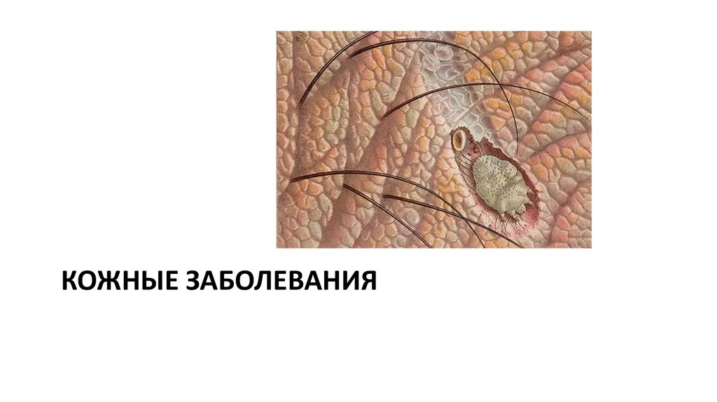 Болезни кожи 8 класс презентация. Заболевания кожи 8 класс. Заболевания кожи 8 класс презентация. Видеоурок болезни и травмы кожи. Заболевания и повреждения кожи