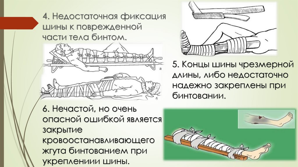 Иммобилизация при ожогах. Ошибки при транспортной иммобилизации. Иммобилизация осложнения. Осложнения транспортной иммобилизации. Ошибки и осложнения при транспортной иммобилизации.