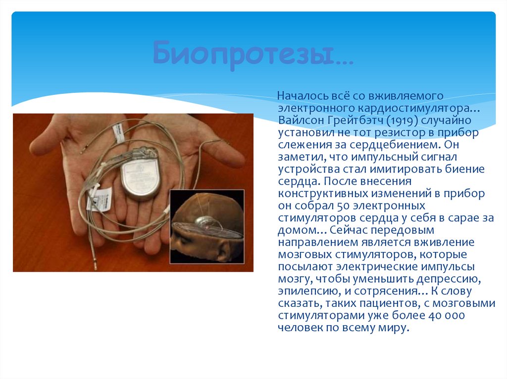 Биопротезы…