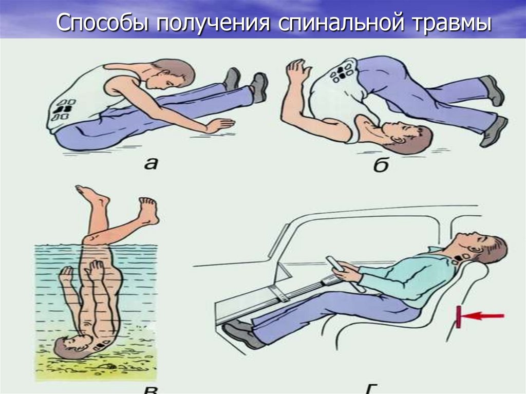 Клиническая картина спинального шока представлена в виде триады