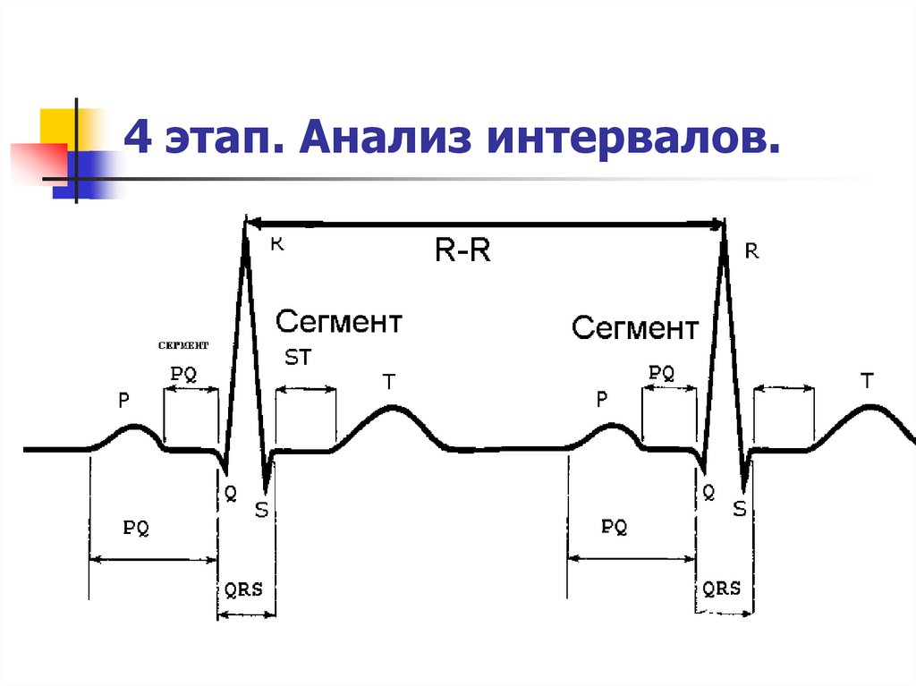 Параметры экг расшифровка