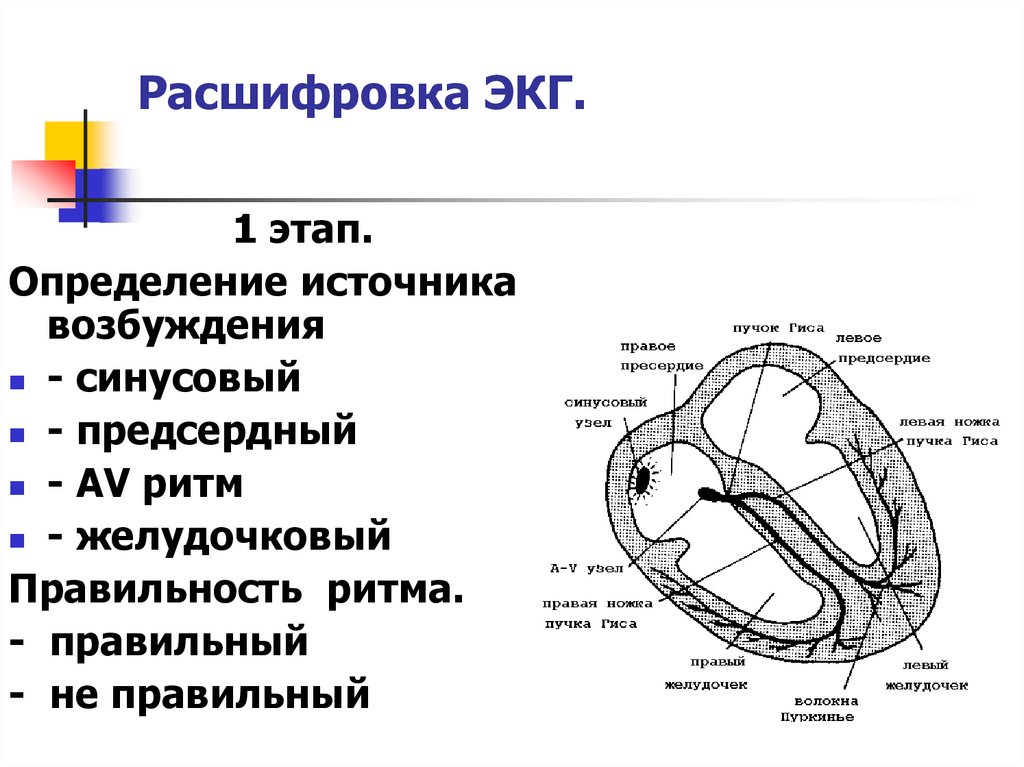 Расшифровка экг презентация