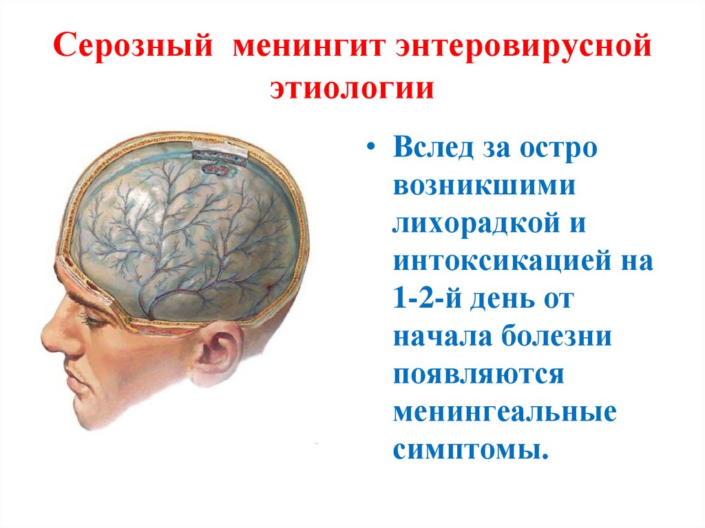 Заболевание оболочки головного мозга. Конвекситальный менингит. Симптомы менингита серозного и Гнойного.