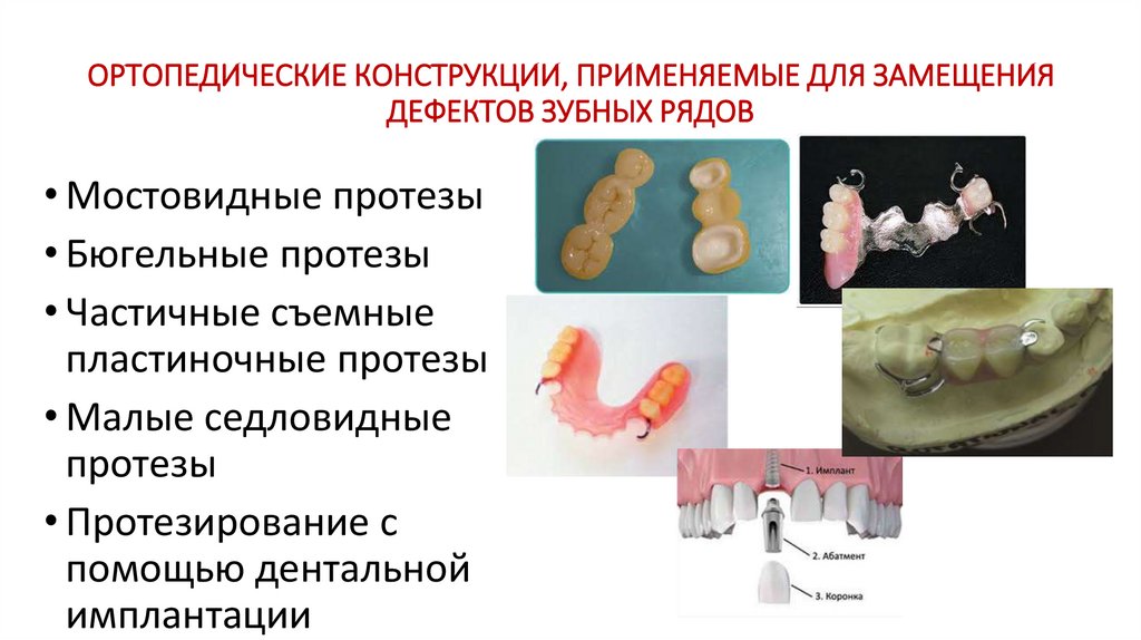 Методы изготовления протезов. Виды ортопедических конструкций в стоматологии. Несъемные ортопедические конструкции в стоматологии. Съемные ортопедические конструкции в стоматологии. Мостовидные конструкции для зубов.